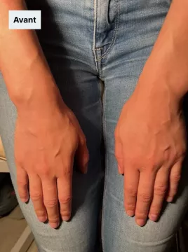 avant-mains