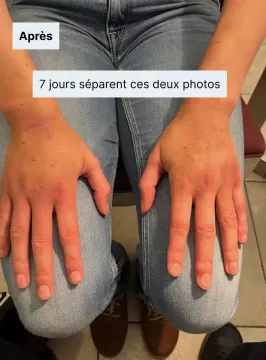 mains-apres